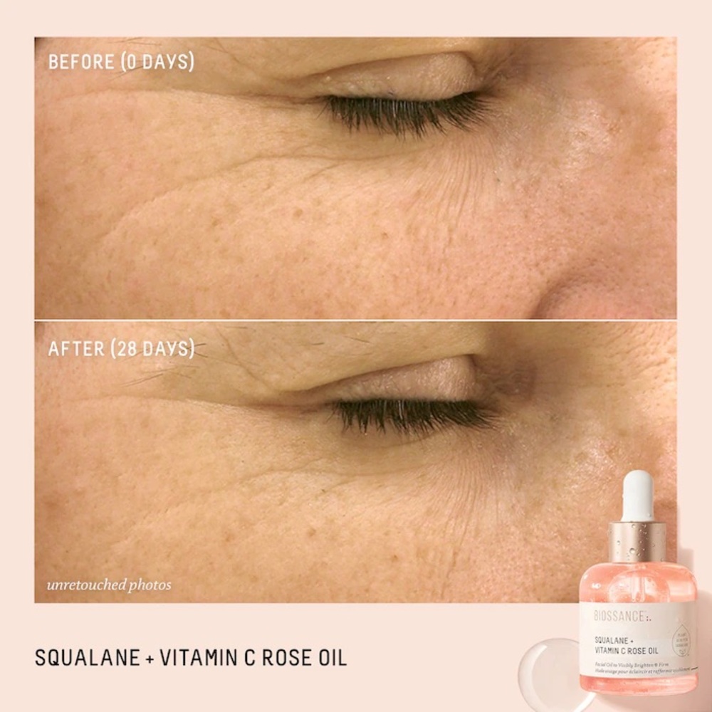 Biossance
Radiantly Rose Duo Set - Picture 4 of 4